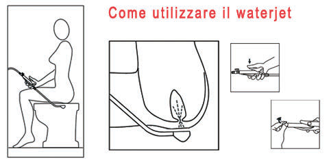 Doccia sanitaria Waterjet per igiene intima, non invasiva, rettale e vaginale